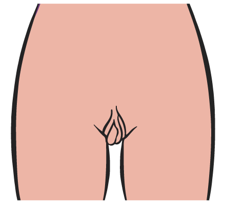 vagina  a forma di paperella